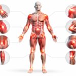 Inomyalgia Explained: Causes, Symptoms, and Effective Ways to Manage Muscle Pain