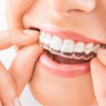 BrassSmile: Complete Guide to Features, Benefits, Safety, and What You Should Know